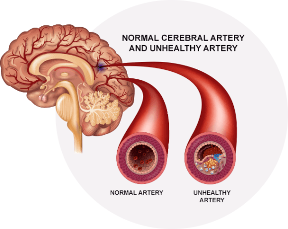 Brain-C-13 Ingredients