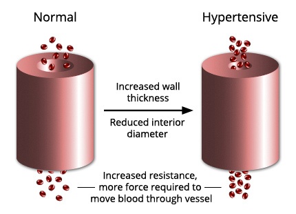 BPS-5 Reviews 2021 - Is Golden After 50 Blood Pressure Supplement Effective?